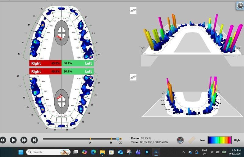 Analiza computerizată a ocluziei T-SCAN la Ki Dental Clinic
